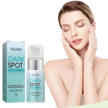 Freckle Whitening Cream Nicotinamide Fade Dark Spot Blemish Acne Mark Brightening Lightening Pigmentation Correction Cream