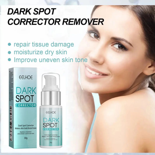 Freckle Whitening Cream Nicotinamide Fade Dark Spot Blemish Acne Mark Brightening Lightening Pigmentation Correction Cream